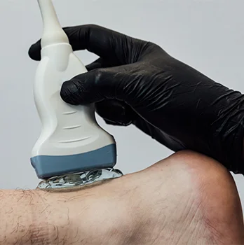 ultrasonido de tendon de aquiles