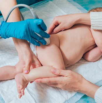 ultrasonido de cadera pediatrico